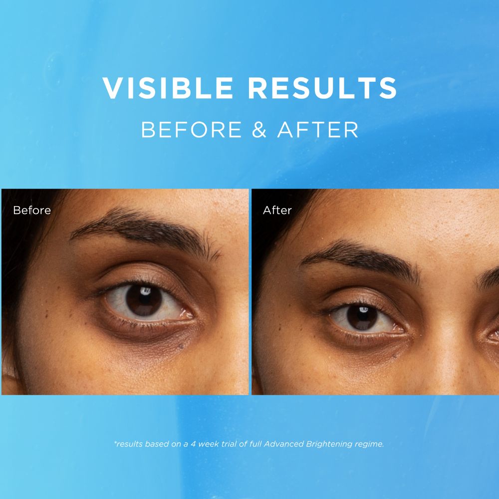 Advanced Brightening Eye Defence Day Cream SPF20