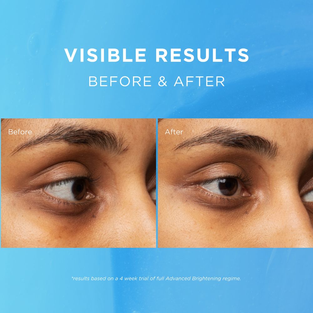 Advanced Brightening Eye Defence Day Cream SPF20